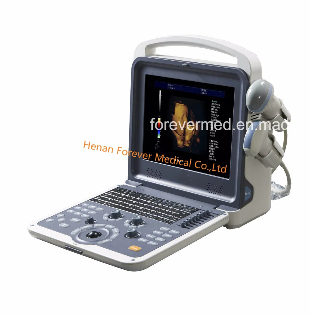 4D Ecografo Maquina De Ultrasonido 3D 4D&4D Ultrasound Scanner