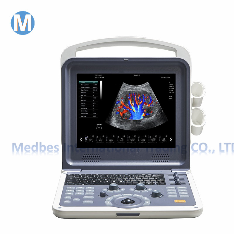 Ce Marked 2D Portable Type Color Doppler Ce Marked 2D Portable Type Color Doppler
