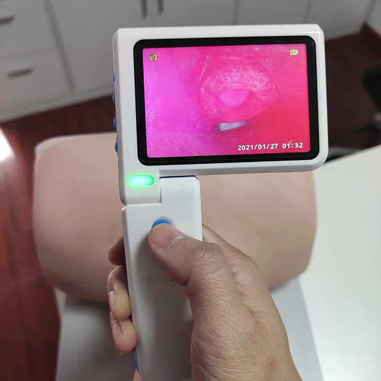 Children Adult Anesthesia Video Laryngoscope Anti-Fog Imaging Visual Laryngoscope