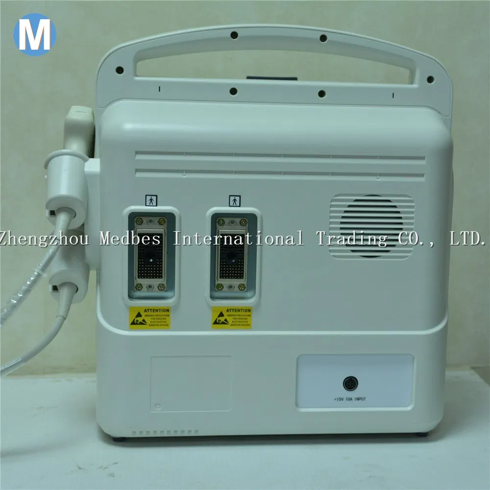 Digital Diagnostic System 2D Ultrasound Machine Digital Diagnostic System 2D Ultrasound Machine