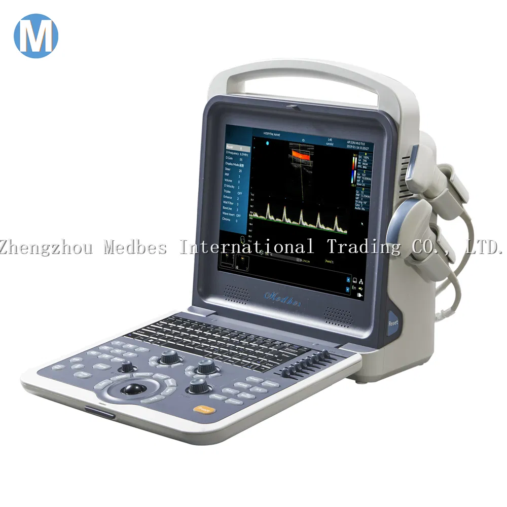 Economical Digital Pregnancy Ultrasonic Ultrasound Scanner