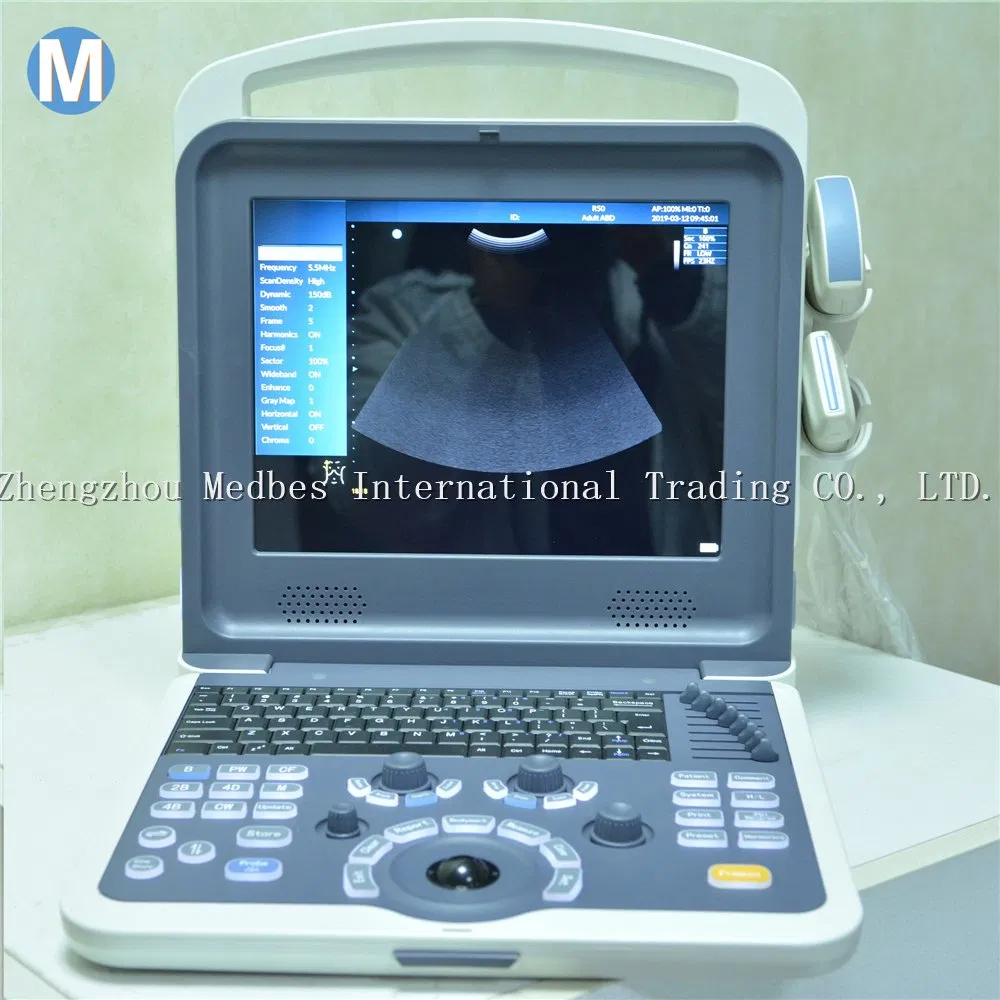 Economical Digital Pregnancy Ultrasonic Ultrasound Scanner