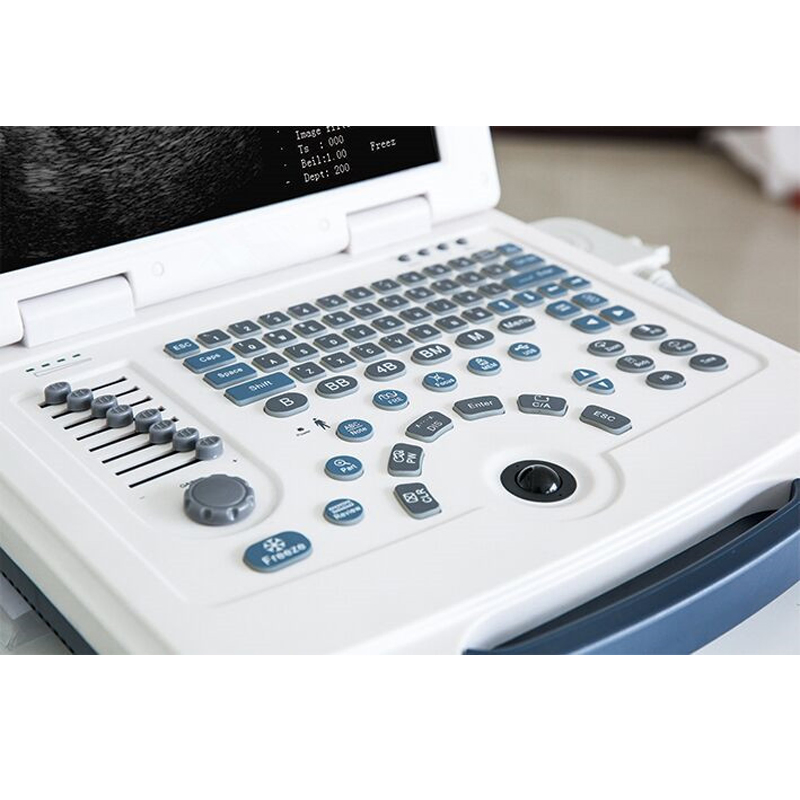 Hc-A003 High Quality Full Digital Portable Laptop Ultrasound Scanner Hc-A003 High Quality Full Digital Portable Laptop Ultrasound Scanner