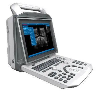 PT6150 Medical Mobile Portable Ultrasound System with LCD, Color Doppler
