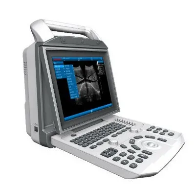 PT6150 Portable Ultrasound System with Advanced Image Processing Technology for Medical Equipment