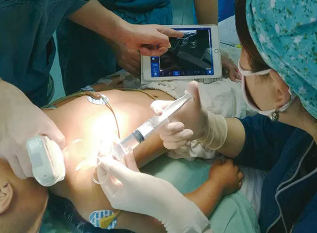 Three-in-One Wireless HD Imaging Color Doppler Ultrasound/128 Matrix HD Ultrasound Color Doppler Scanner/2D Portable Ultrasound Doppler