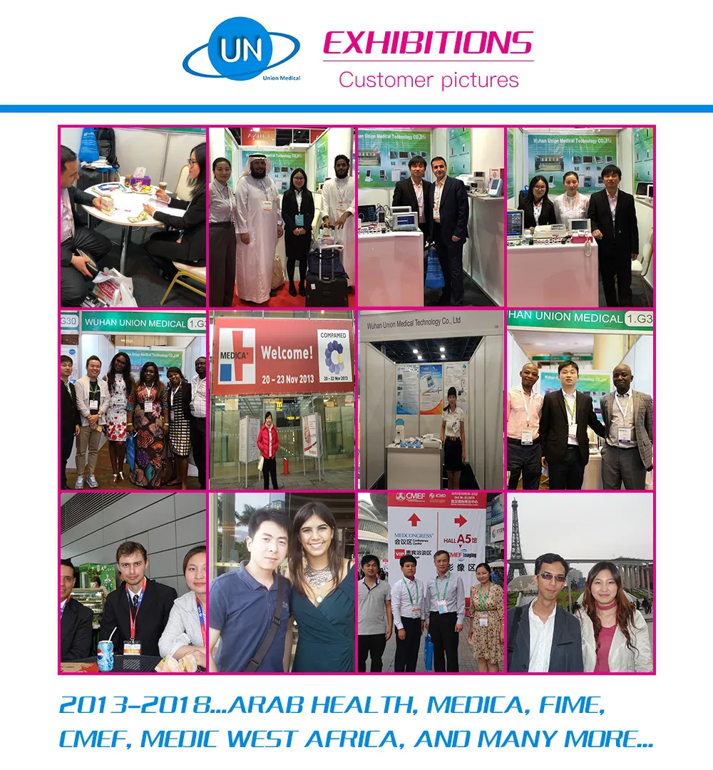 Unborn Bbaby Ultrasonic Maternal Fetal Doppler Monitor Price